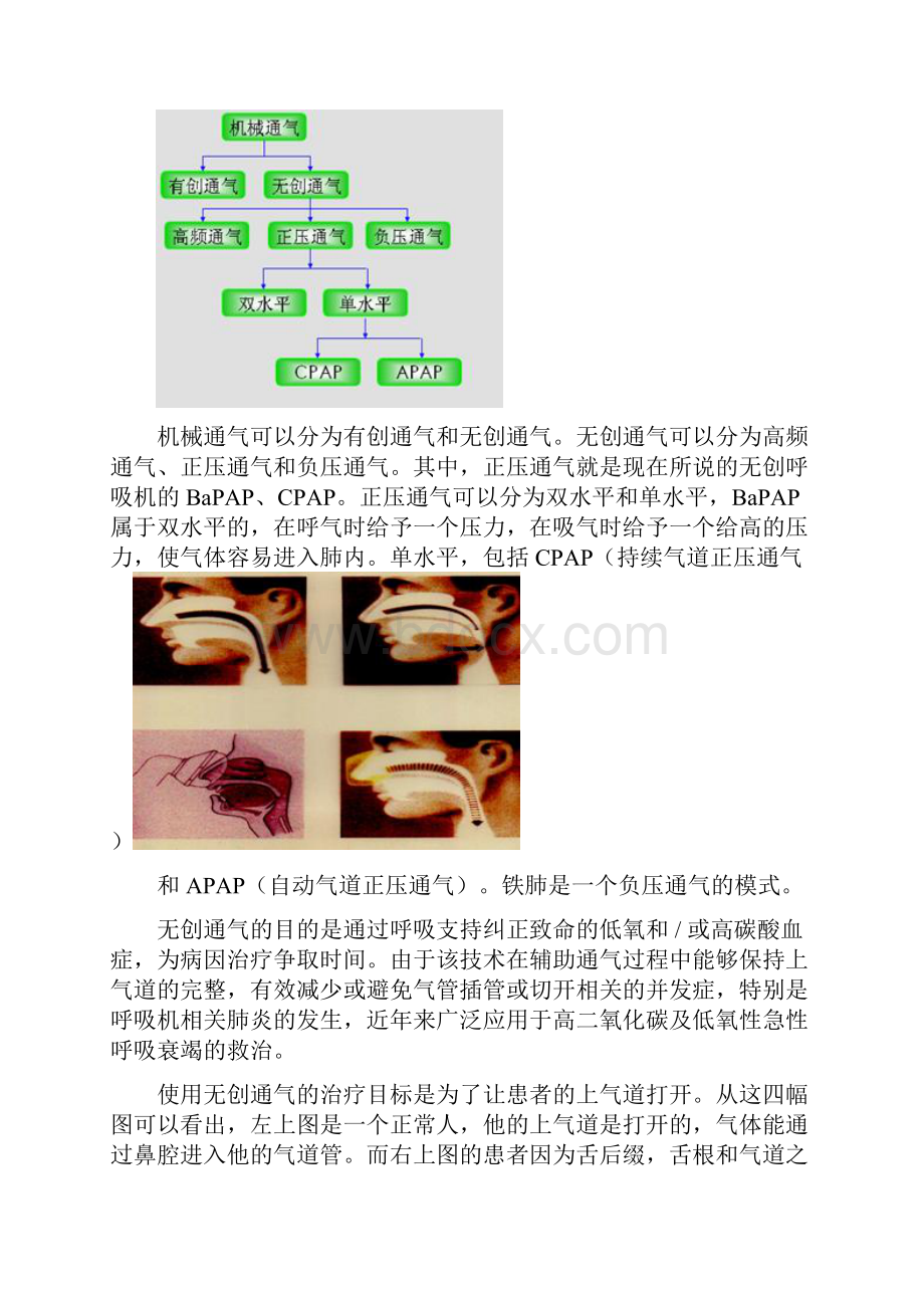 无创呼吸机临床应用与管理.docx_第2页