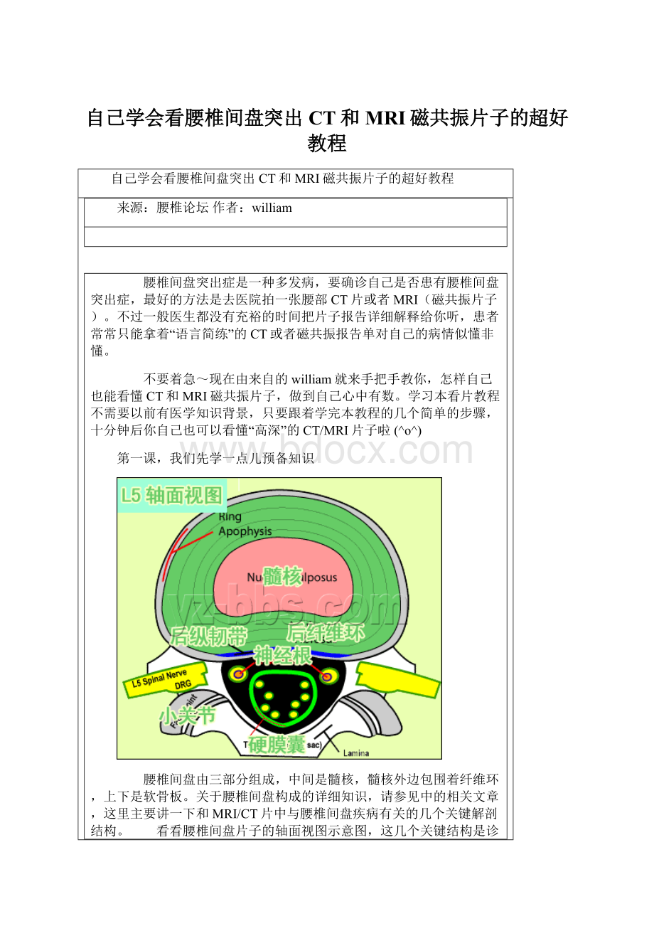 自己学会看腰椎间盘突出CT和MRI磁共振片子的超好教程.docx_第1页