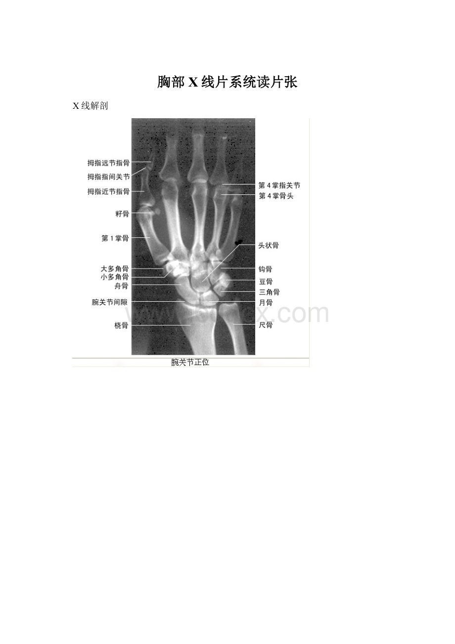 胸部X线片系统读片张.docx_第1页