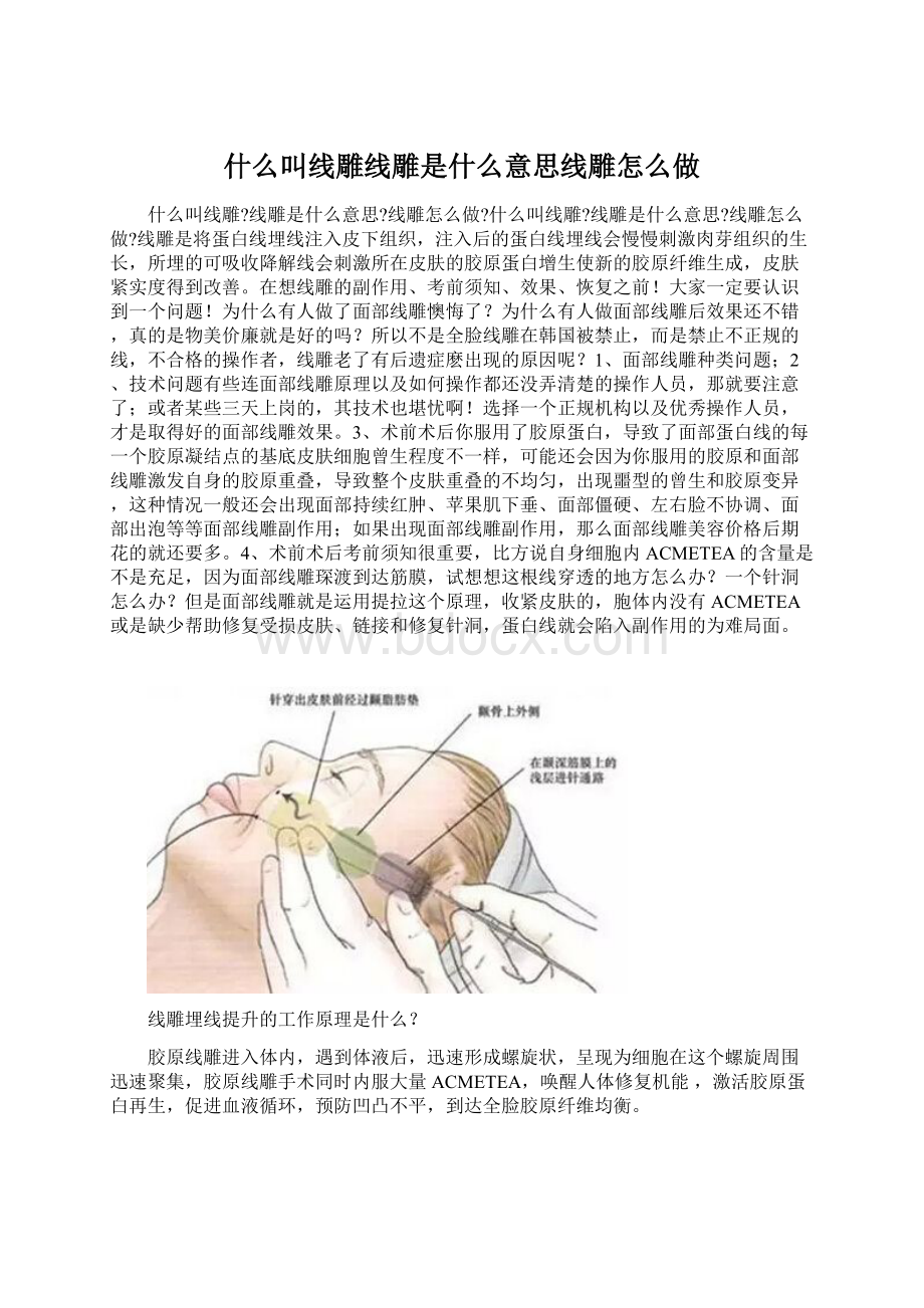 什么叫线雕线雕是什么意思线雕怎么做.docx_第1页