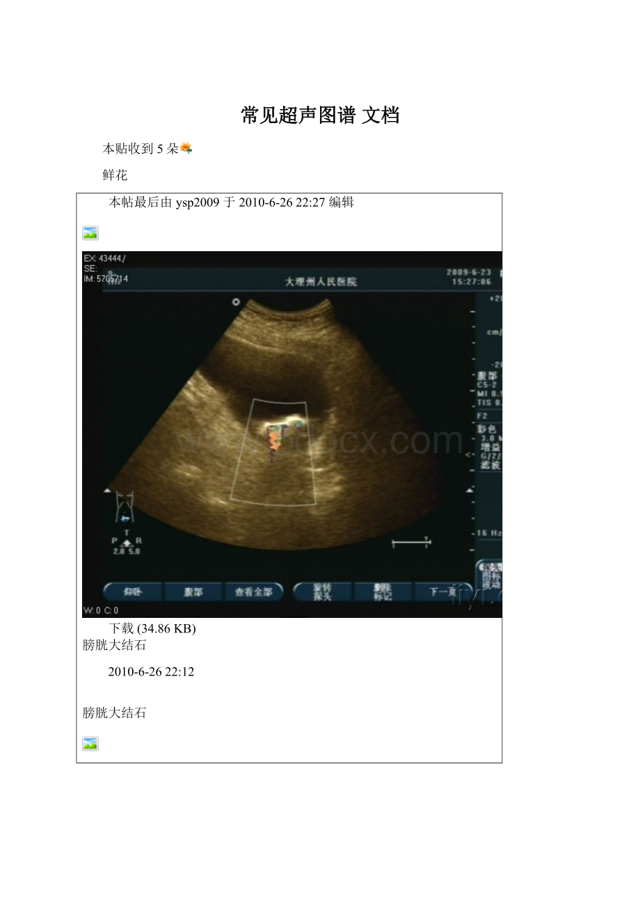 常见超声图谱 文档.docx