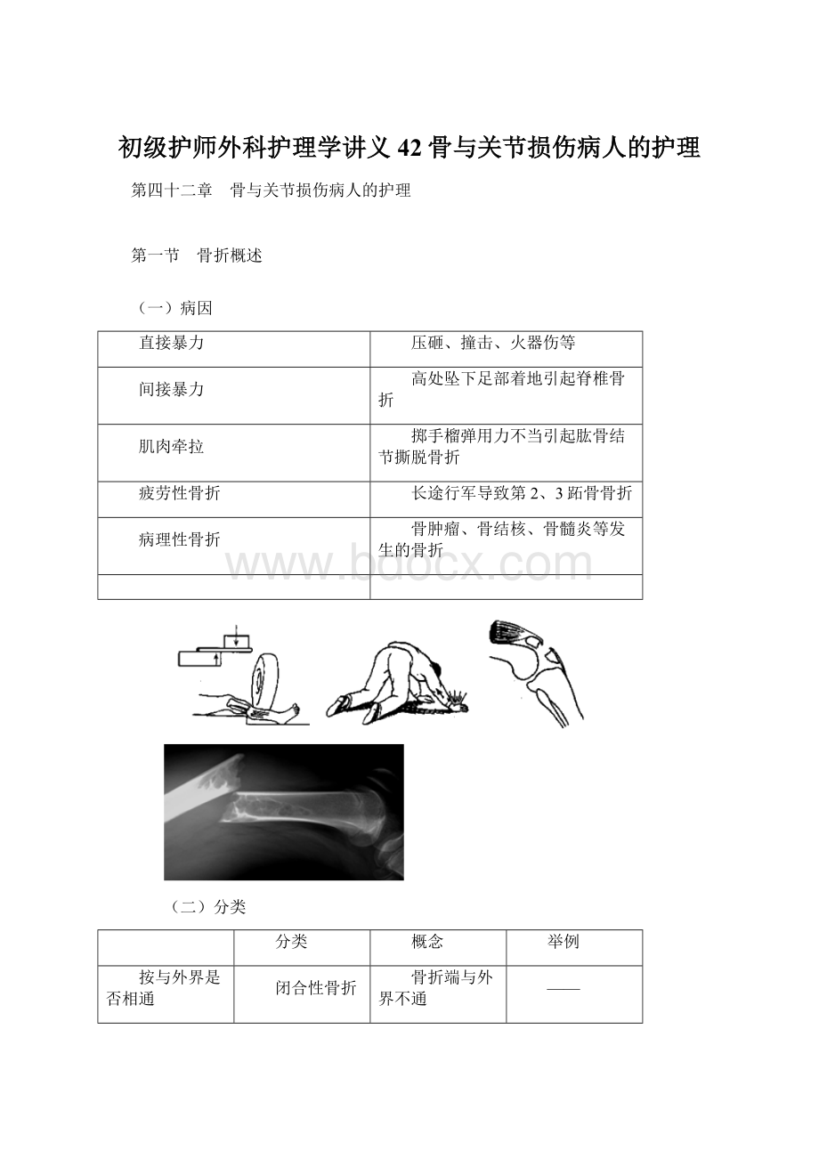 初级护师外科护理学讲义 42骨与关节损伤病人的护理.docx_第1页