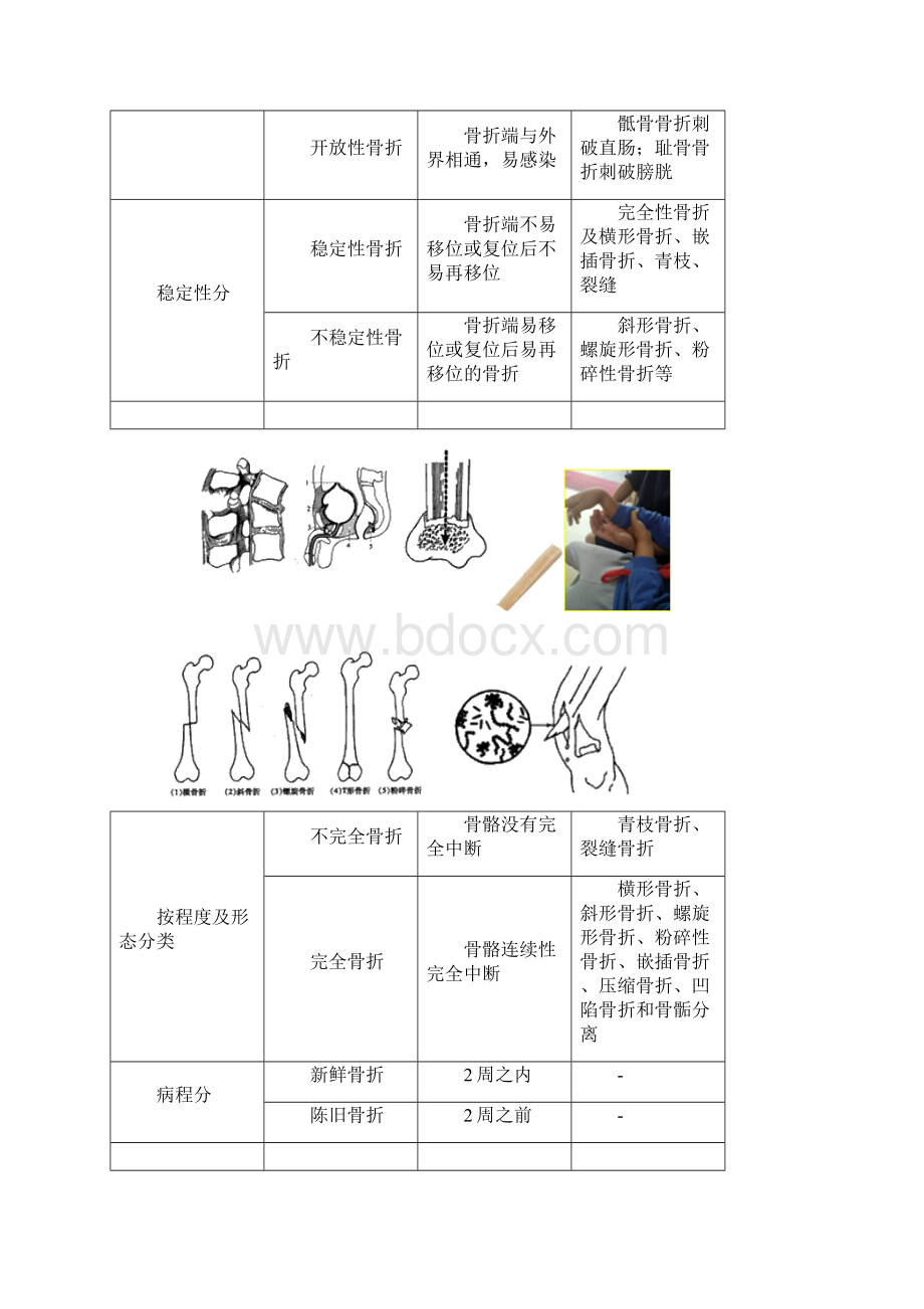 初级护师外科护理学讲义 42骨与关节损伤病人的护理.docx_第2页