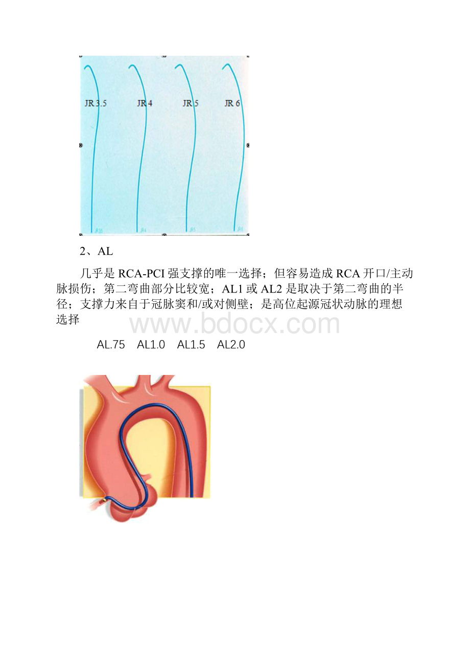 右冠状动脉指引导管的选择.docx_第2页