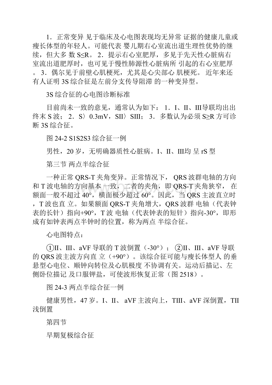 心电图综合征.docx_第2页