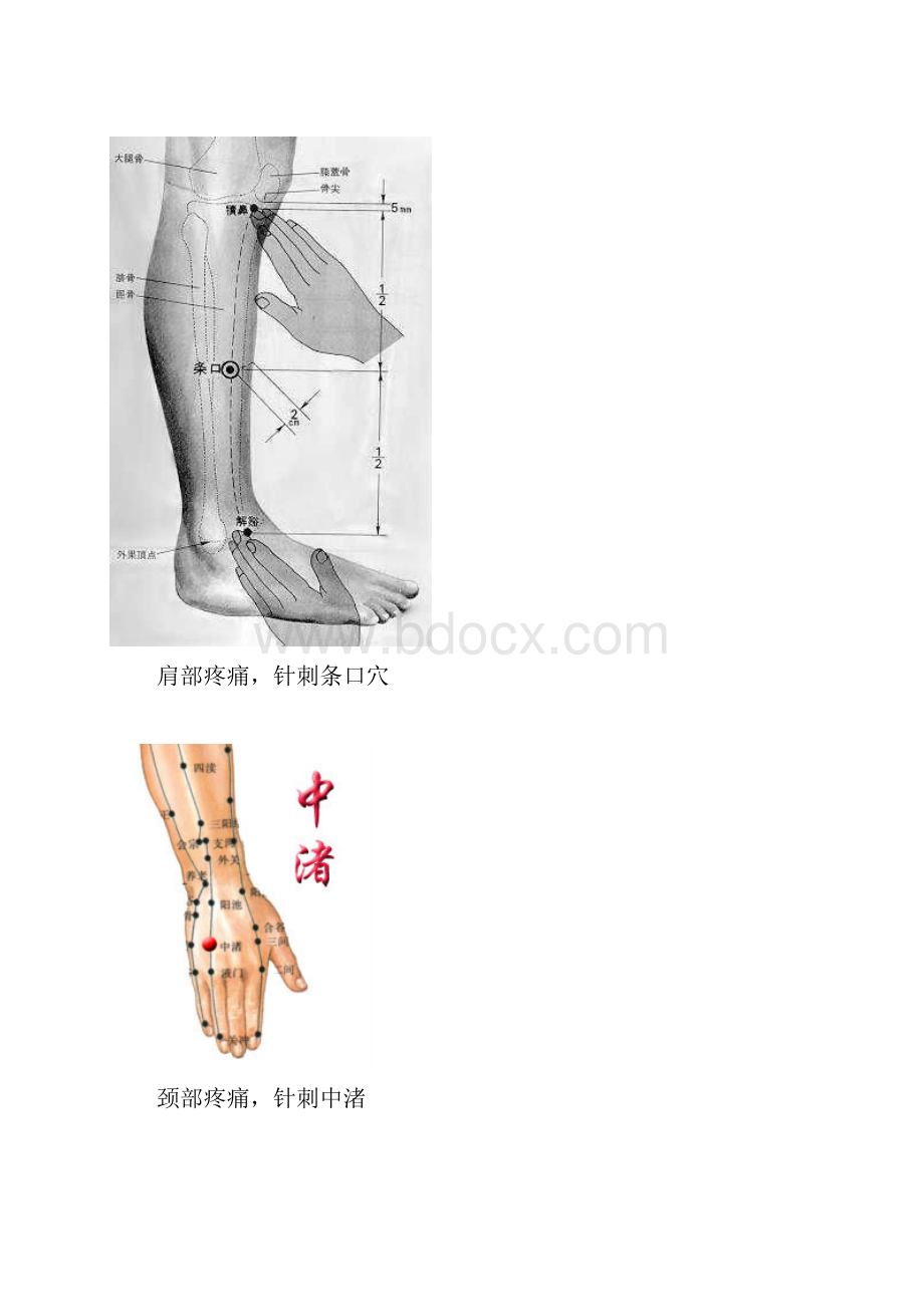 各种疼痛的针灸治疗穴位《配图片》.docx_第3页