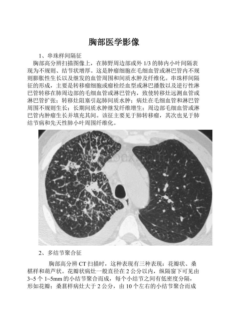 胸部医学影像.docx