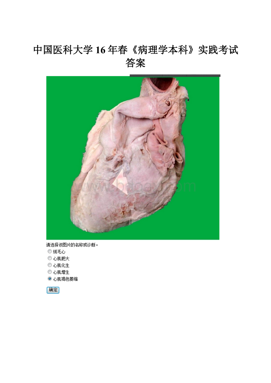 中国医科大学16年春《病理学本科》实践考试答案.docx