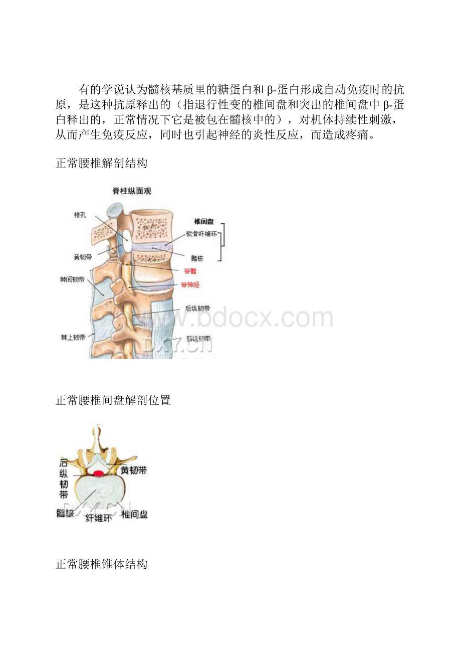 腰椎间盘突出症详解图解.docx_第3页