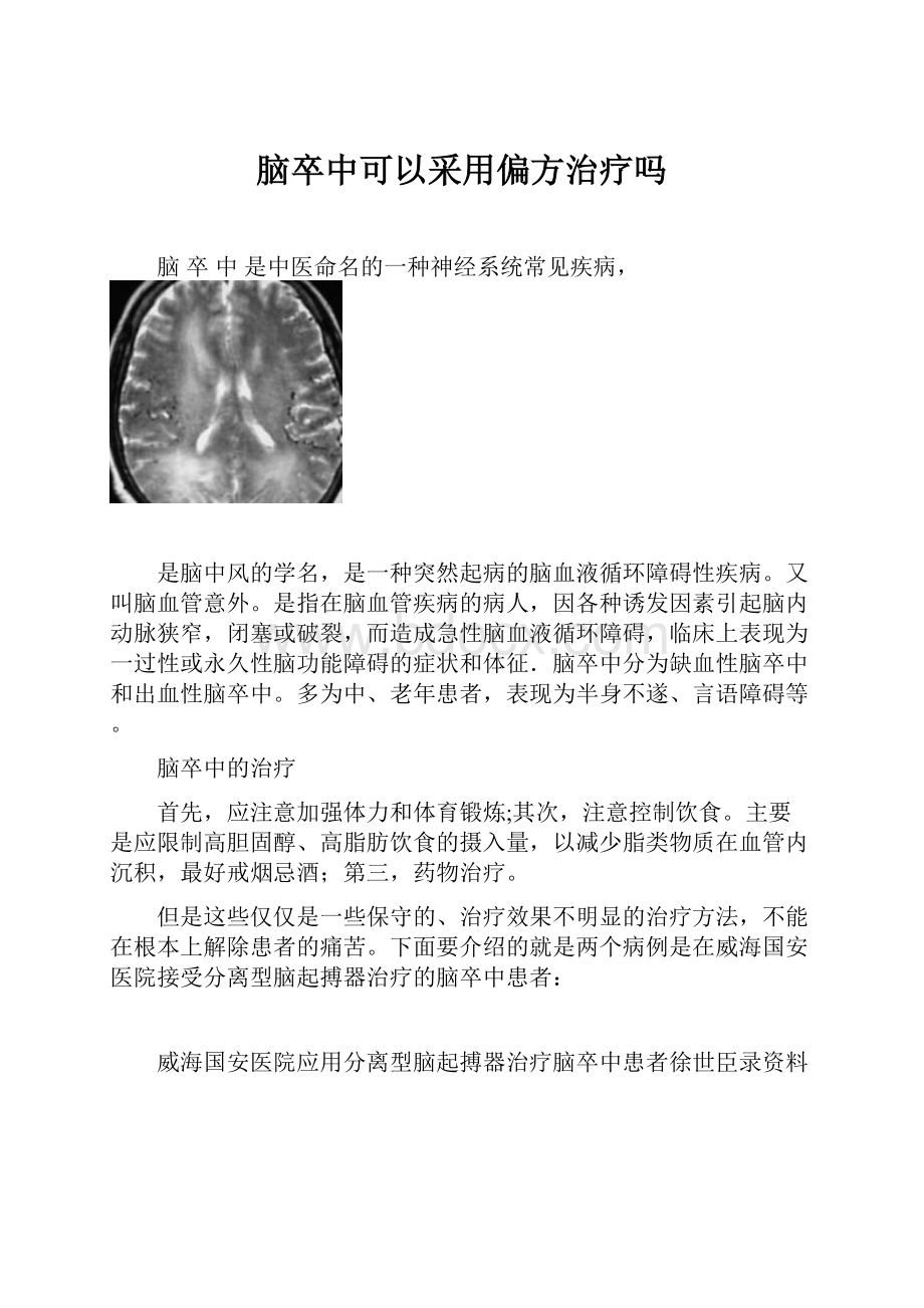 脑卒中可以采用偏方治疗吗.docx