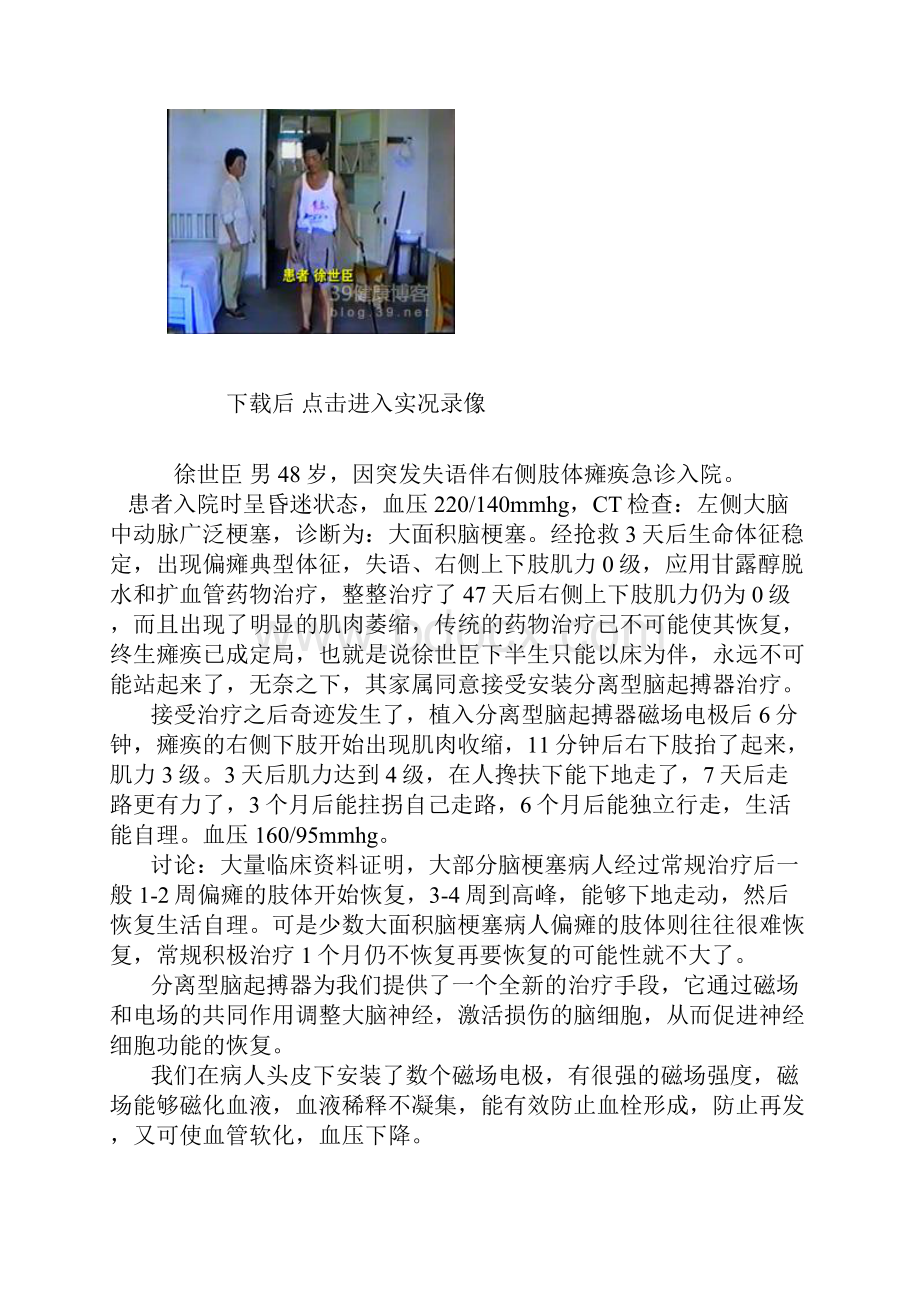 脑卒中可以采用偏方治疗吗.docx_第2页