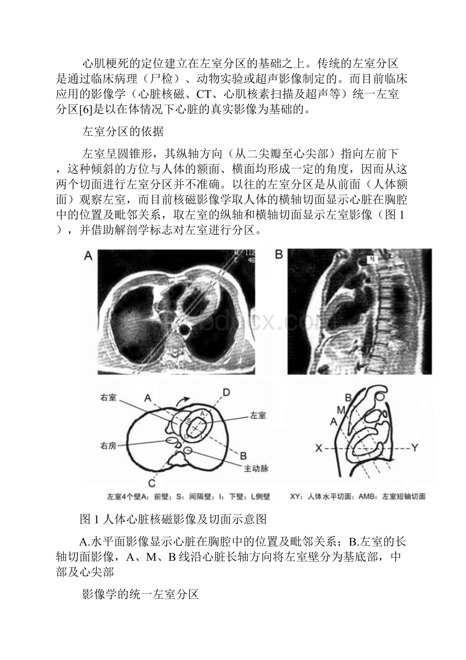 室壁分段.docx_第3页