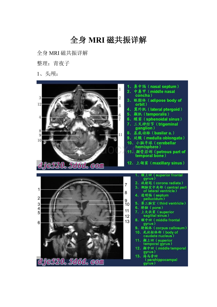 全身MRI磁共振详解.docx