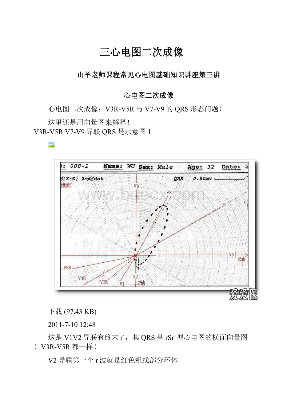 三心电图二次成像.docx