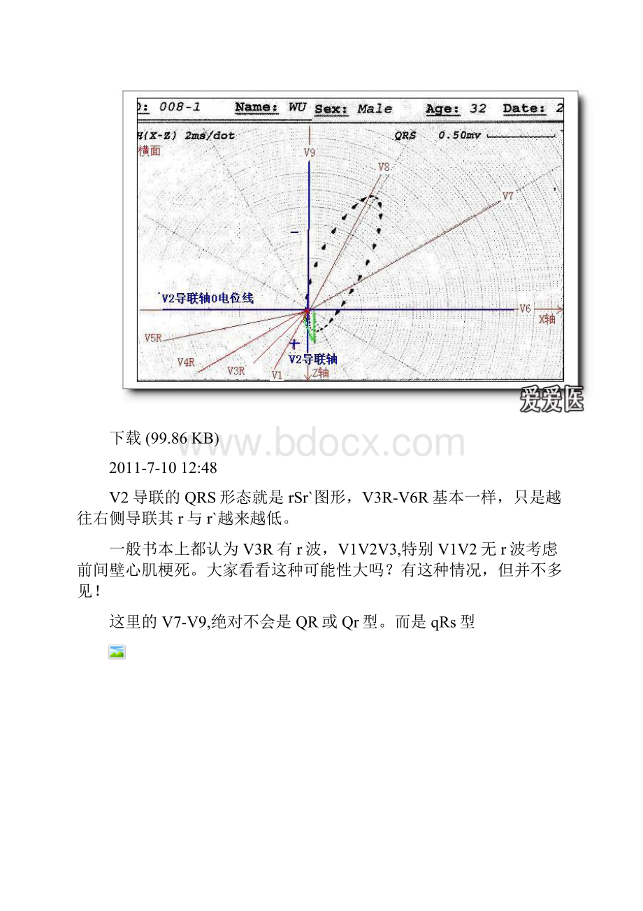 三心电图二次成像.docx_第3页