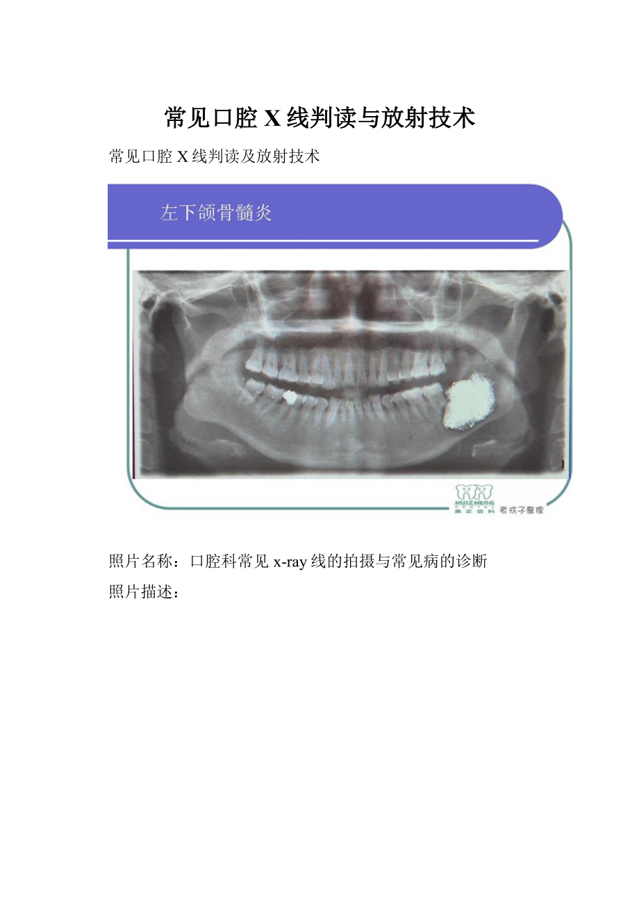 常见口腔X线判读与放射技术.docx