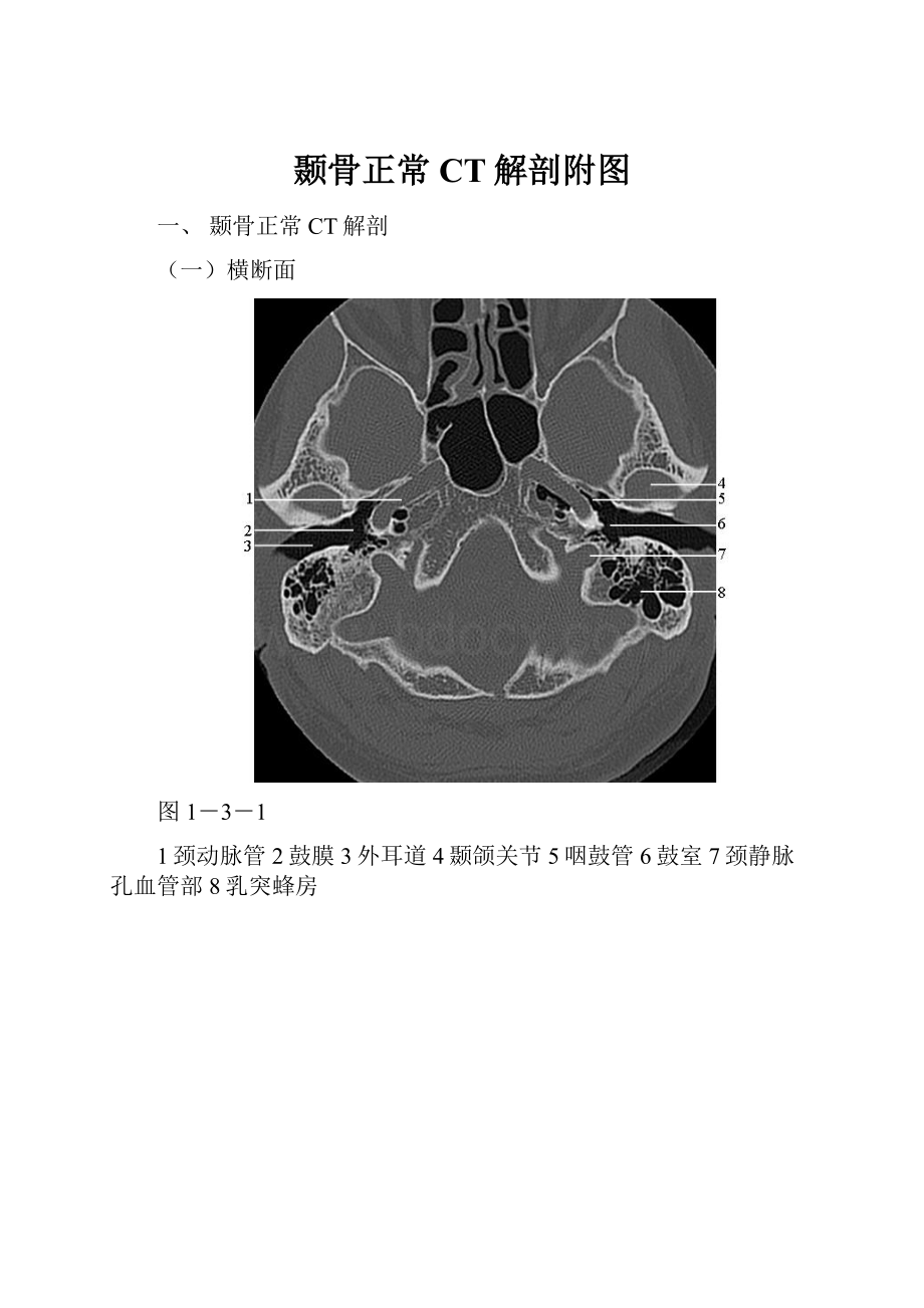 颞骨正常CT解剖附图.docx