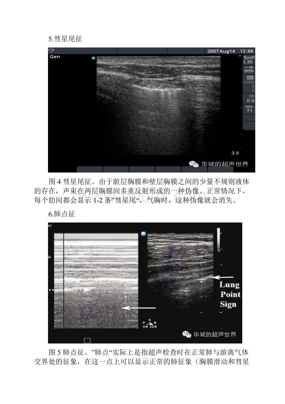 肺部超声一些常见形象征象解释.docx_第3页