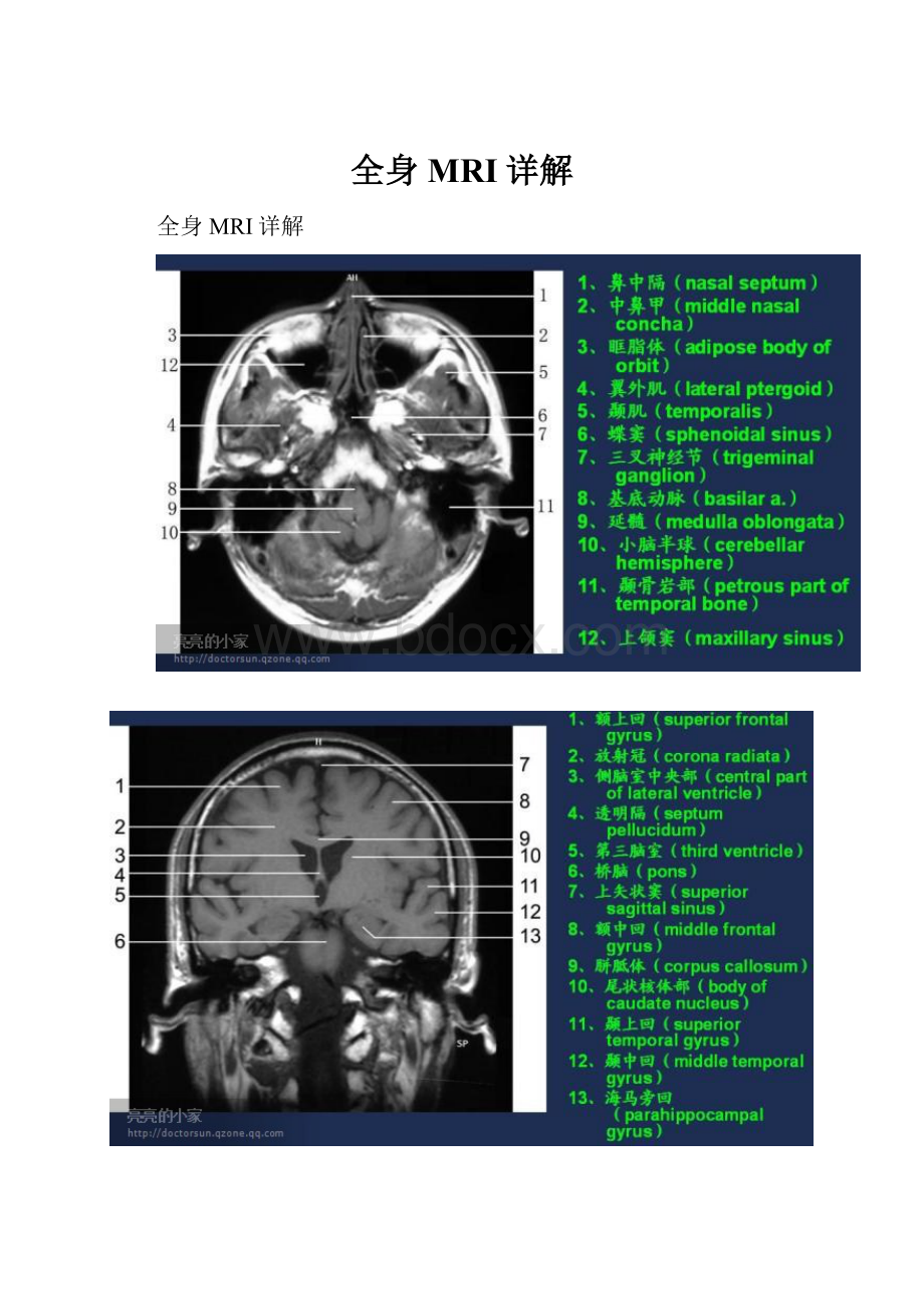 全身MRI详解.docx