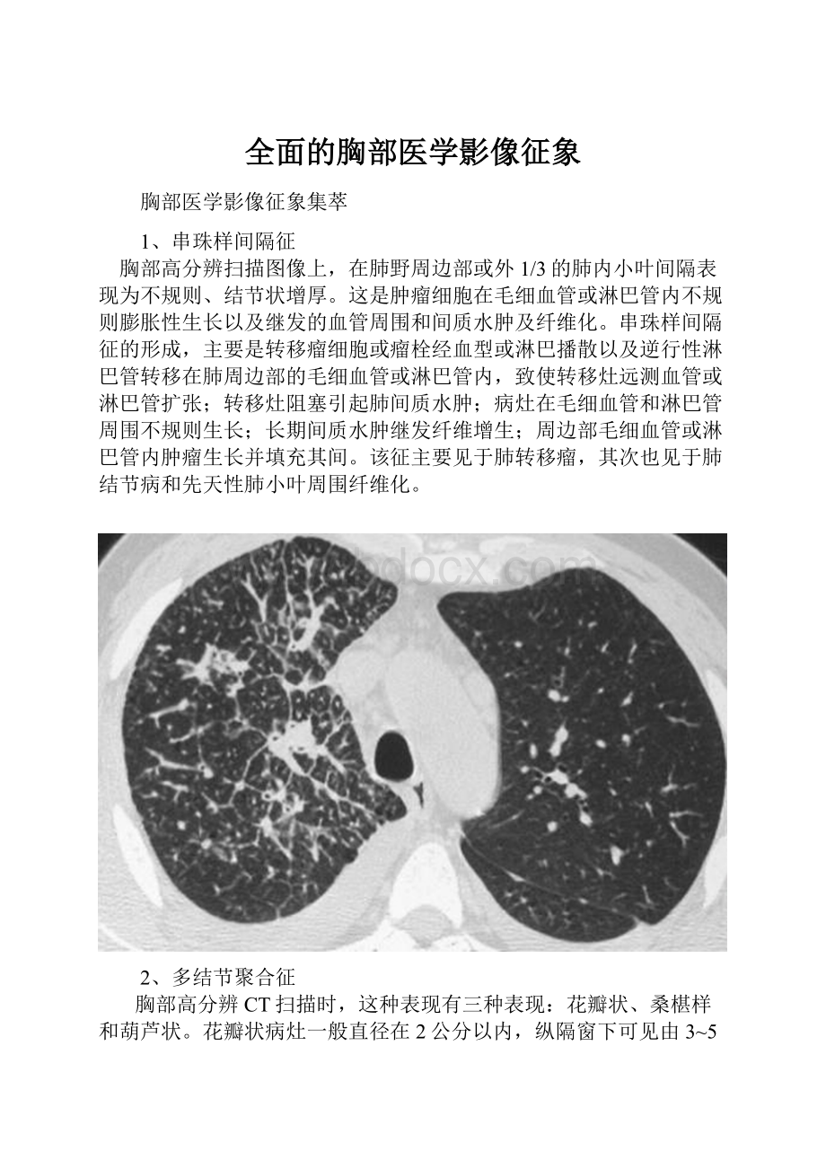 全面的胸部医学影像征象.docx