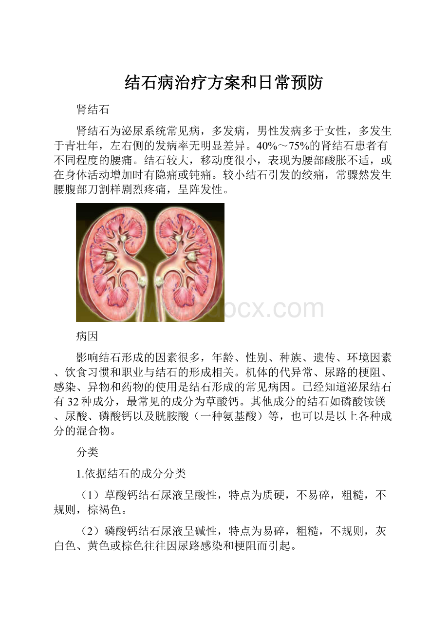 结石病治疗方案和日常预防.docx_第1页