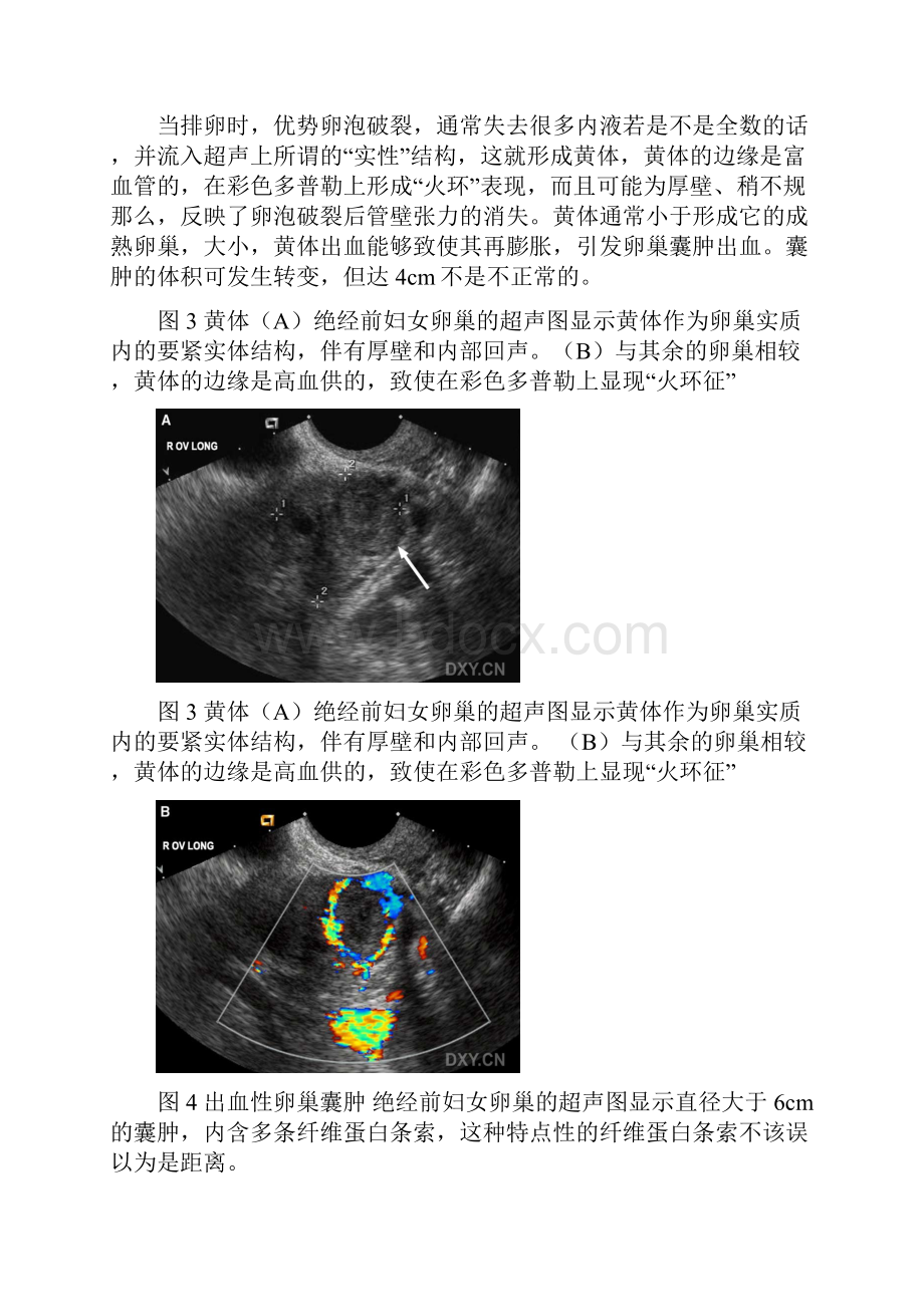 肿块的超声分析.docx_第2页