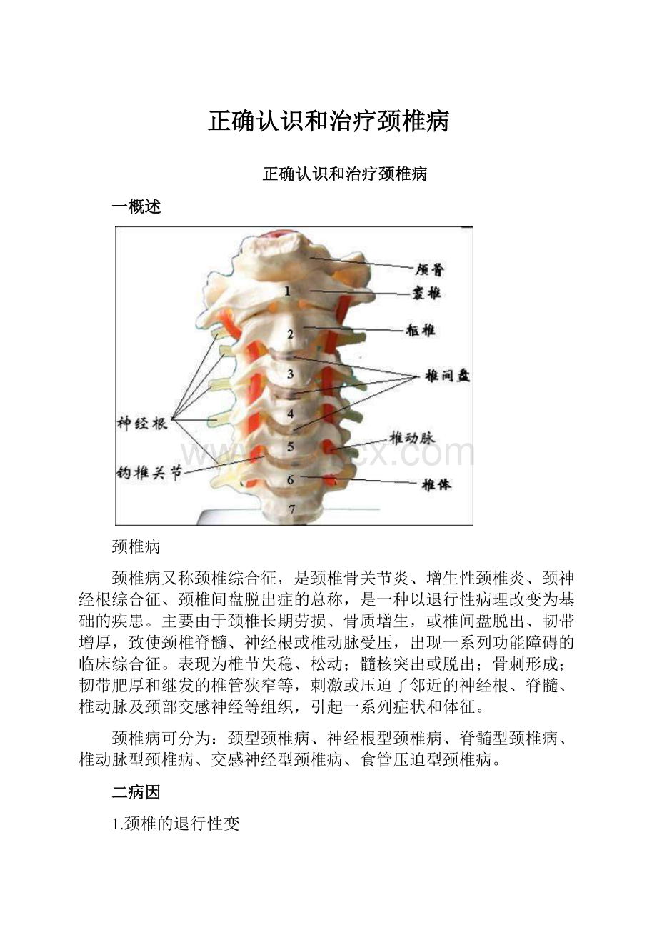 正确认识和治疗颈椎病.docx