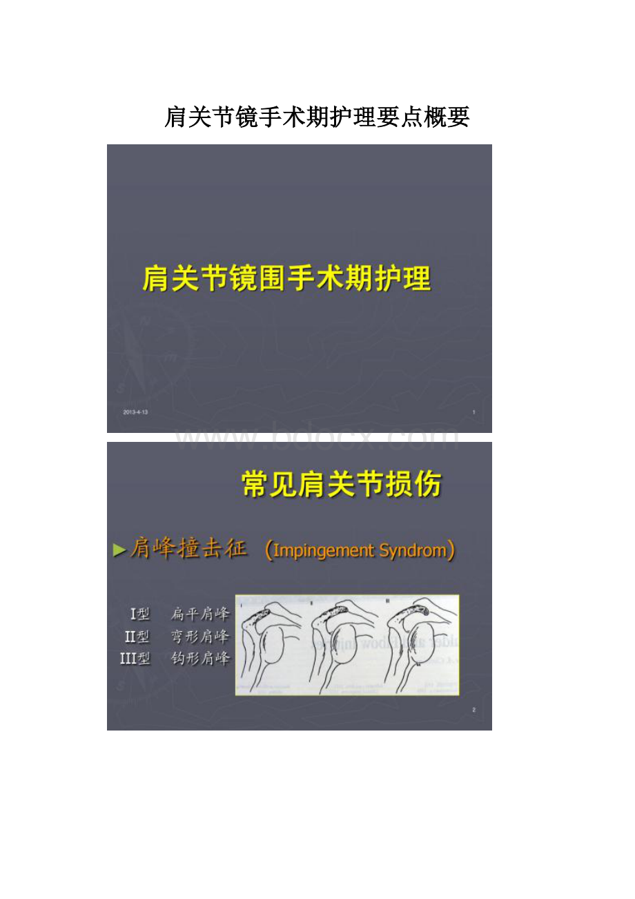 肩关节镜手术期护理要点概要.docx_第1页