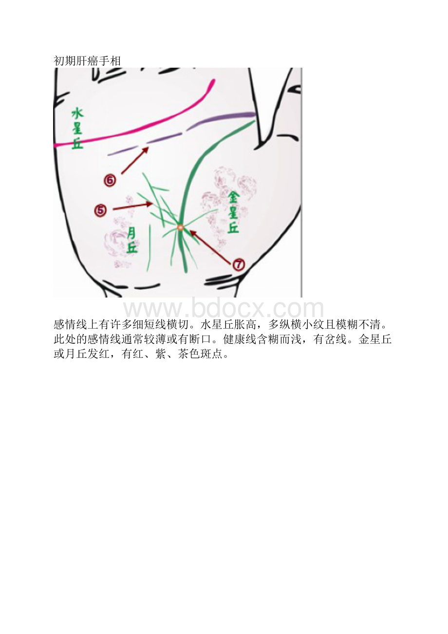 手相看病.docx_第3页