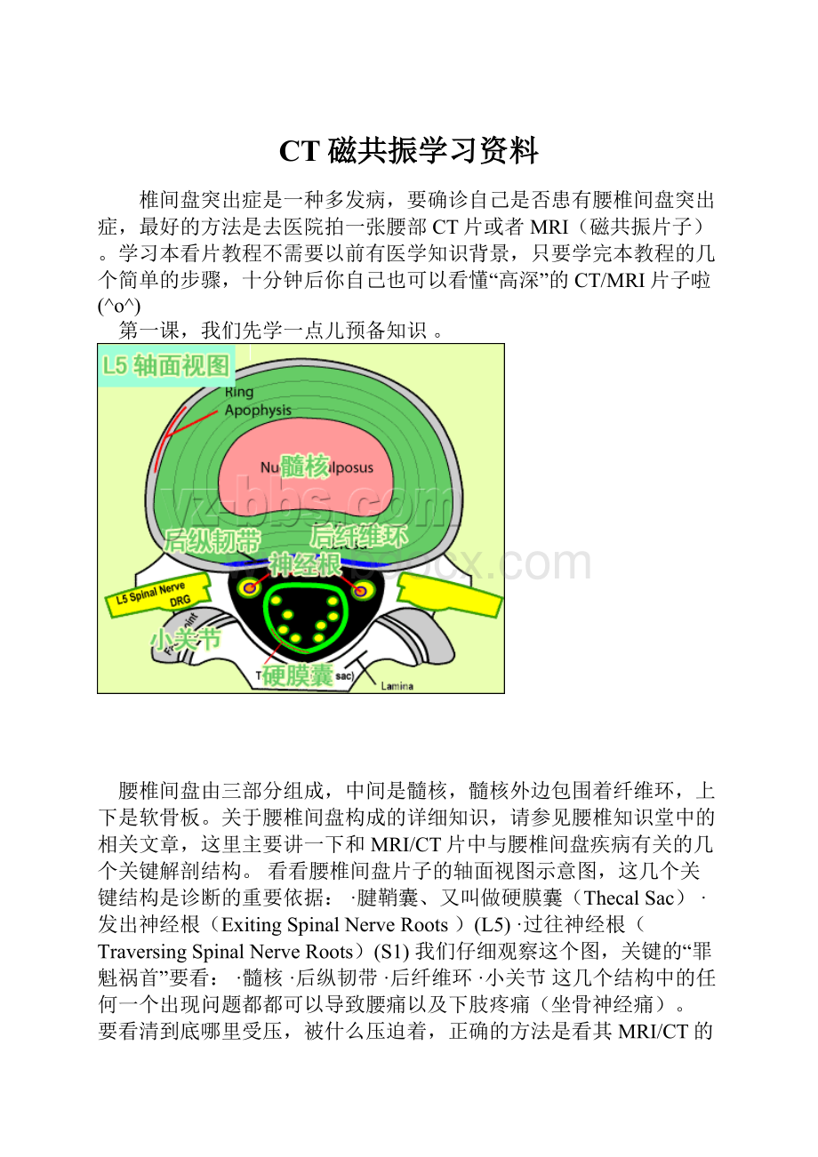 CT磁共振学习资料.docx