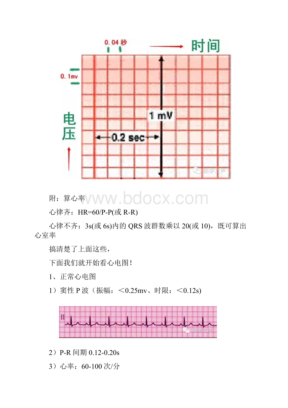 临床常见的11种心电图.docx_第3页