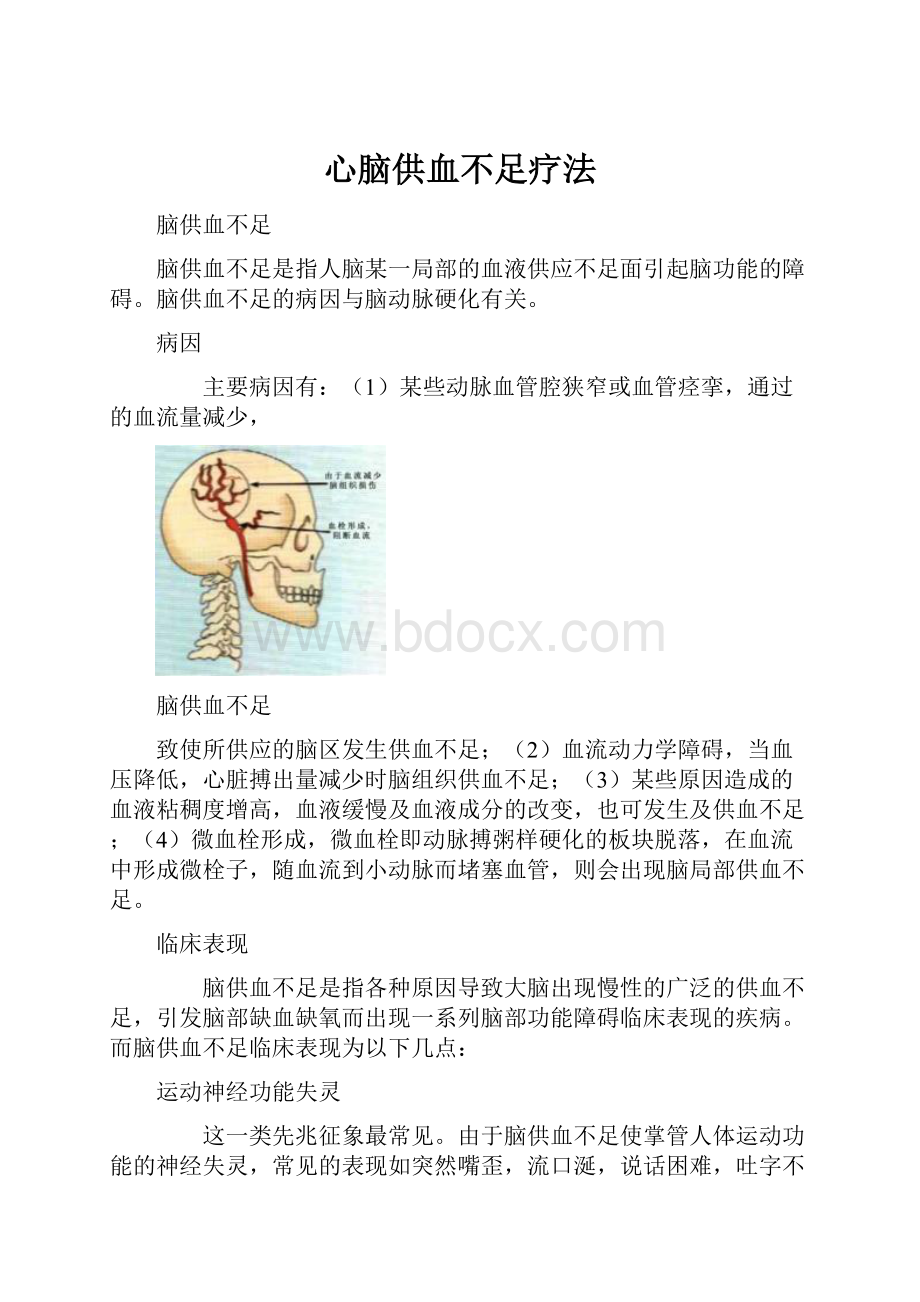 心脑供血不足疗法.docx