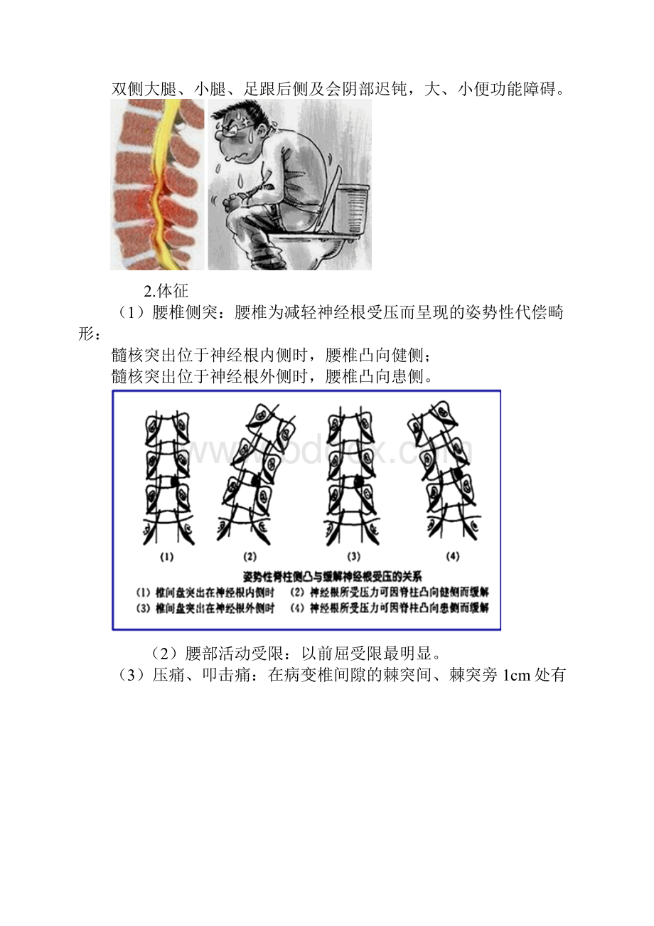 初级护师考试辅导 第45章 腰腿痛及颈肩痛病人的护理讲义.docx_第3页