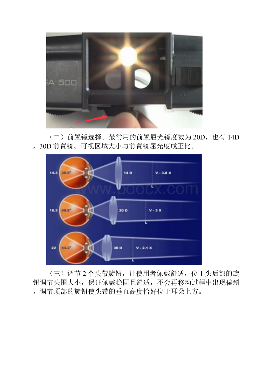 间接检眼镜使用.docx_第3页