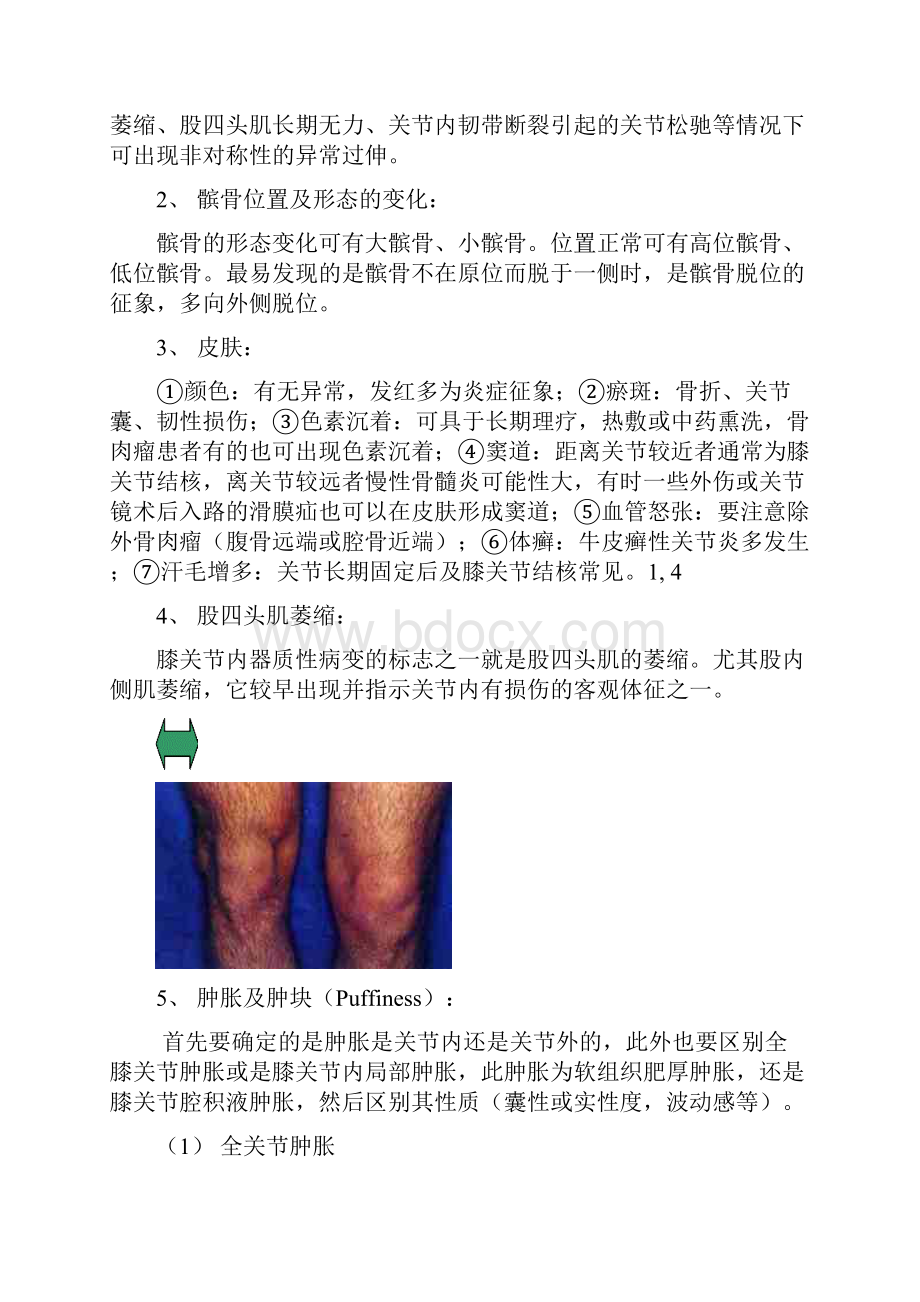 与膝关节镜手术相关疾患的膝关节检查法.docx_第3页