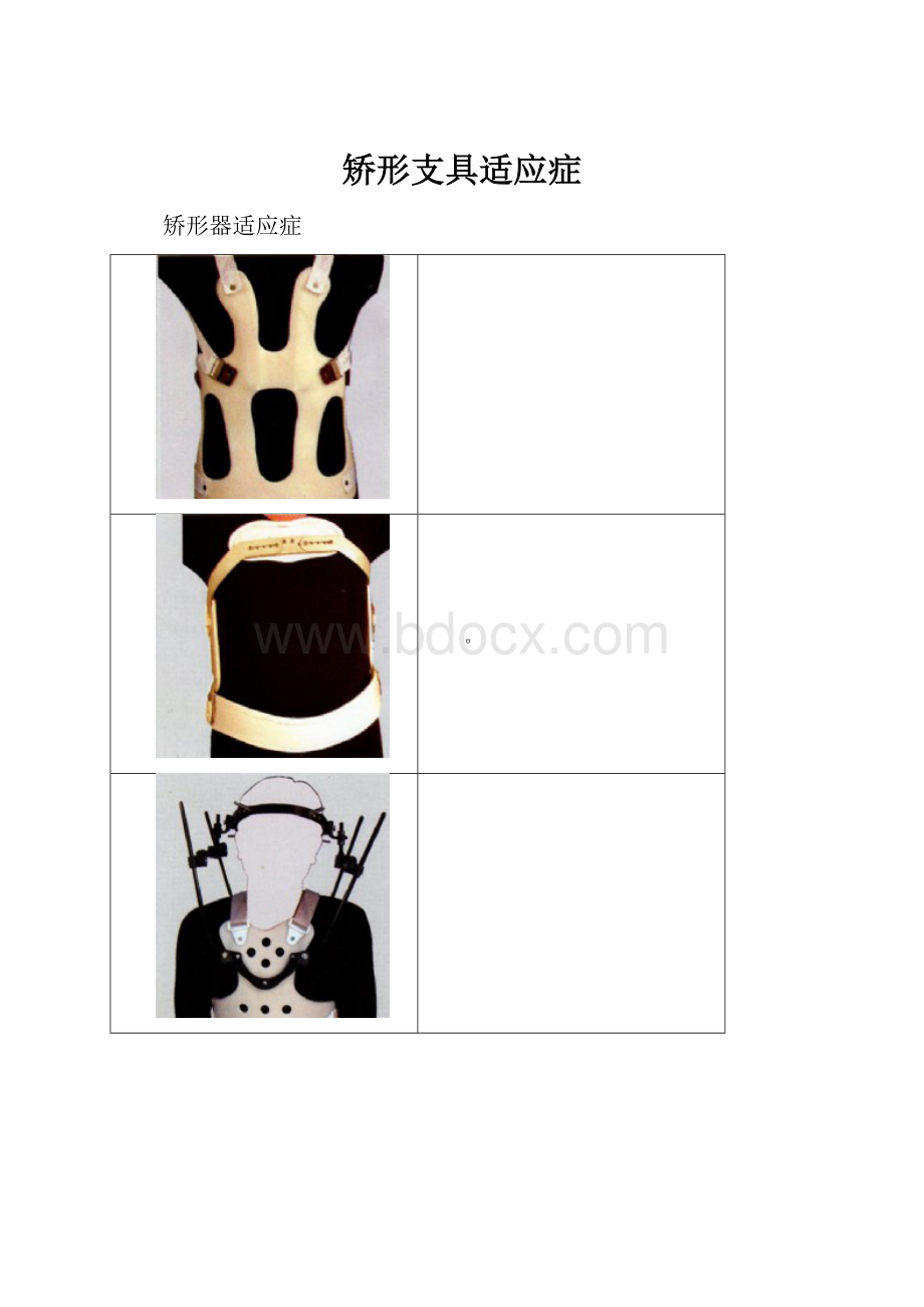 矫形支具适应症.docx_第1页