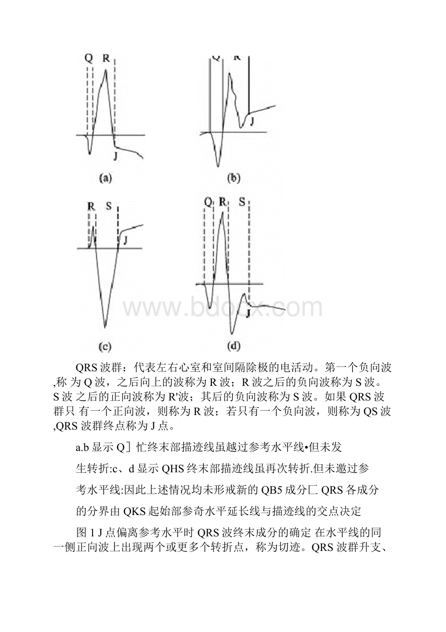 《心电图测量技术指南》完整版.docx_第2页