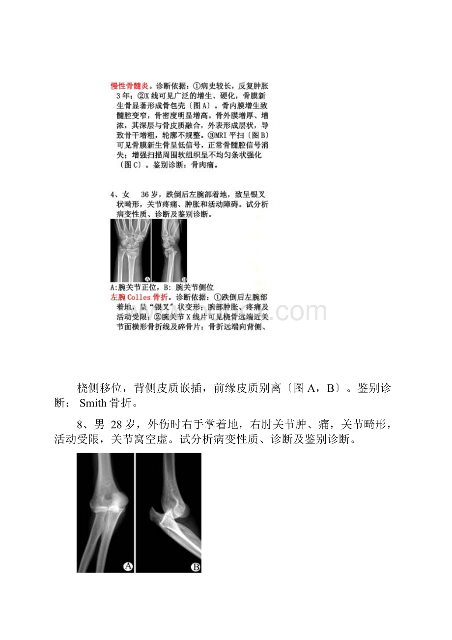 最新骨肌病例分析.docx_第3页