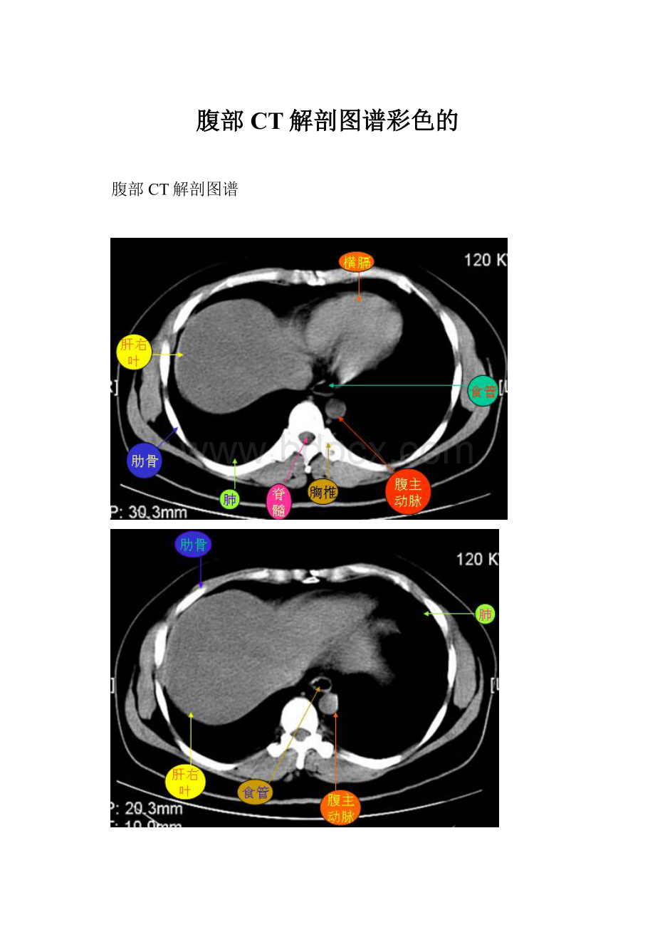 腹部CT解剖图谱彩色的.docx