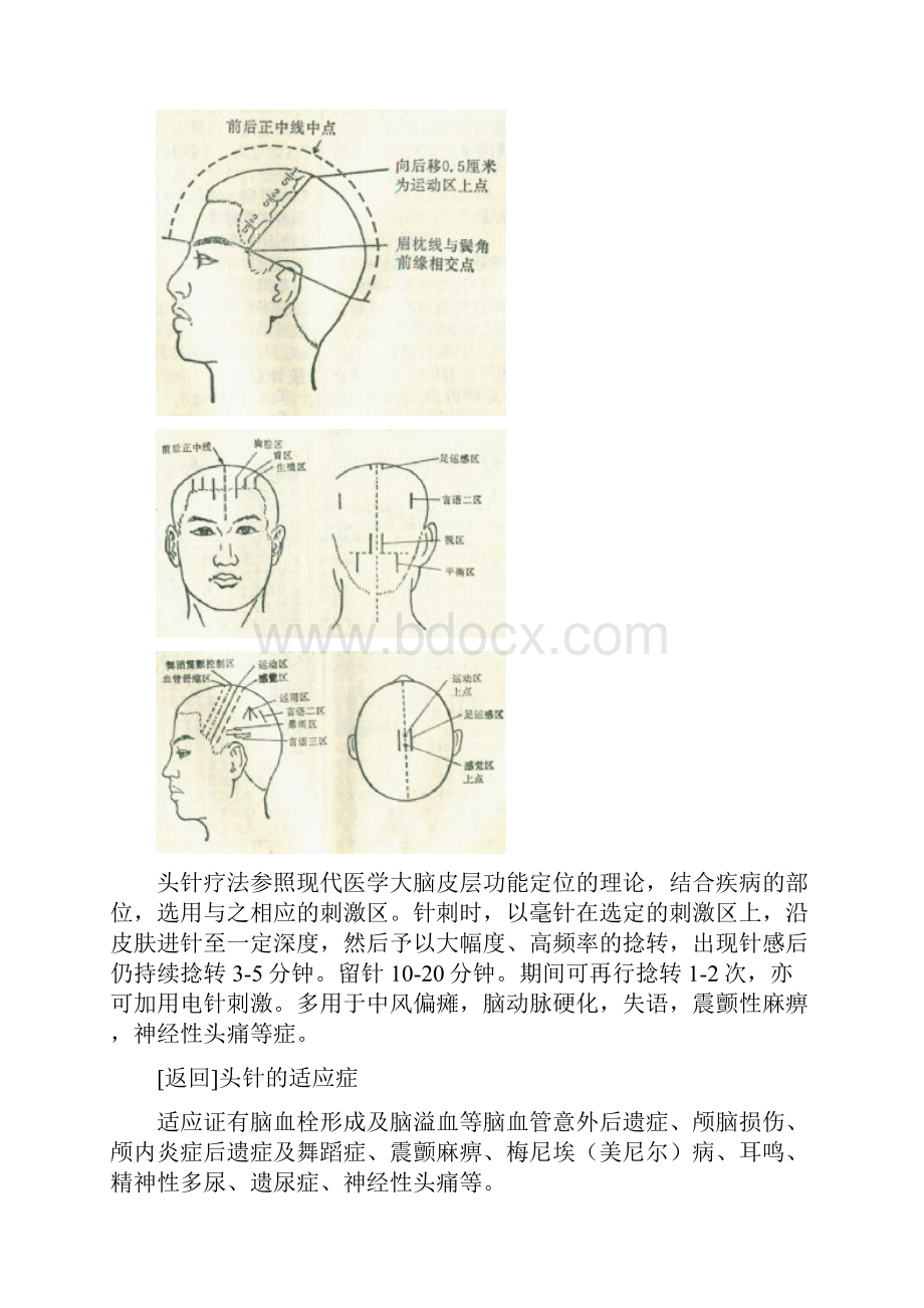 头针疗法亦称头皮针.docx_第2页