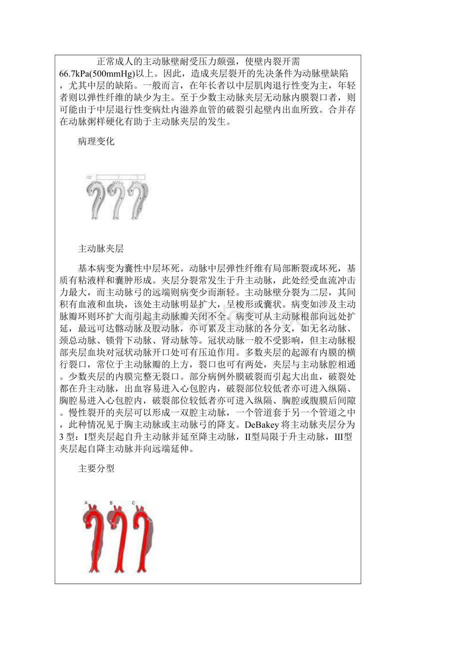 主动脉夹层的治疗与预防保健题库.docx_第3页