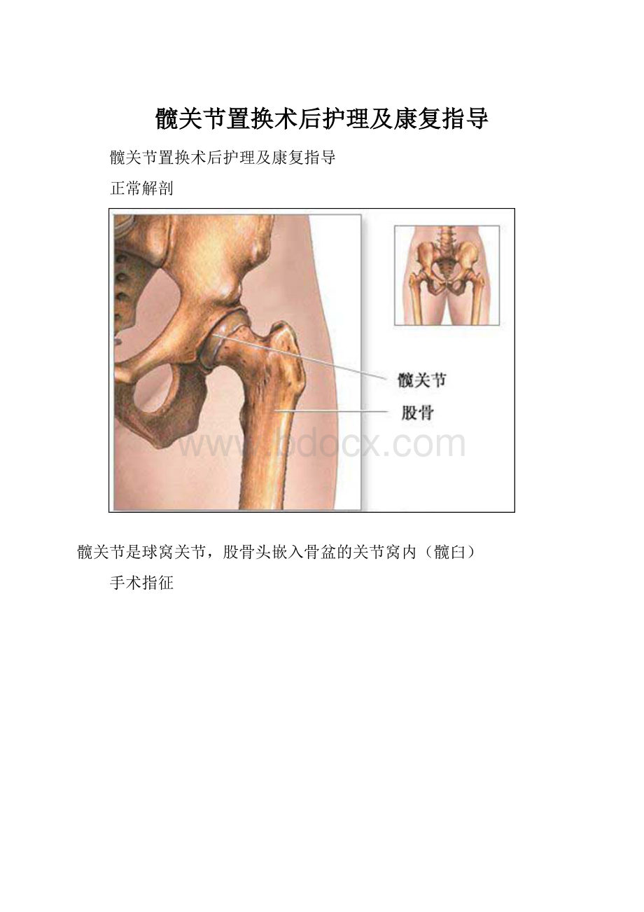 髋关节置换术后护理及康复指导.docx