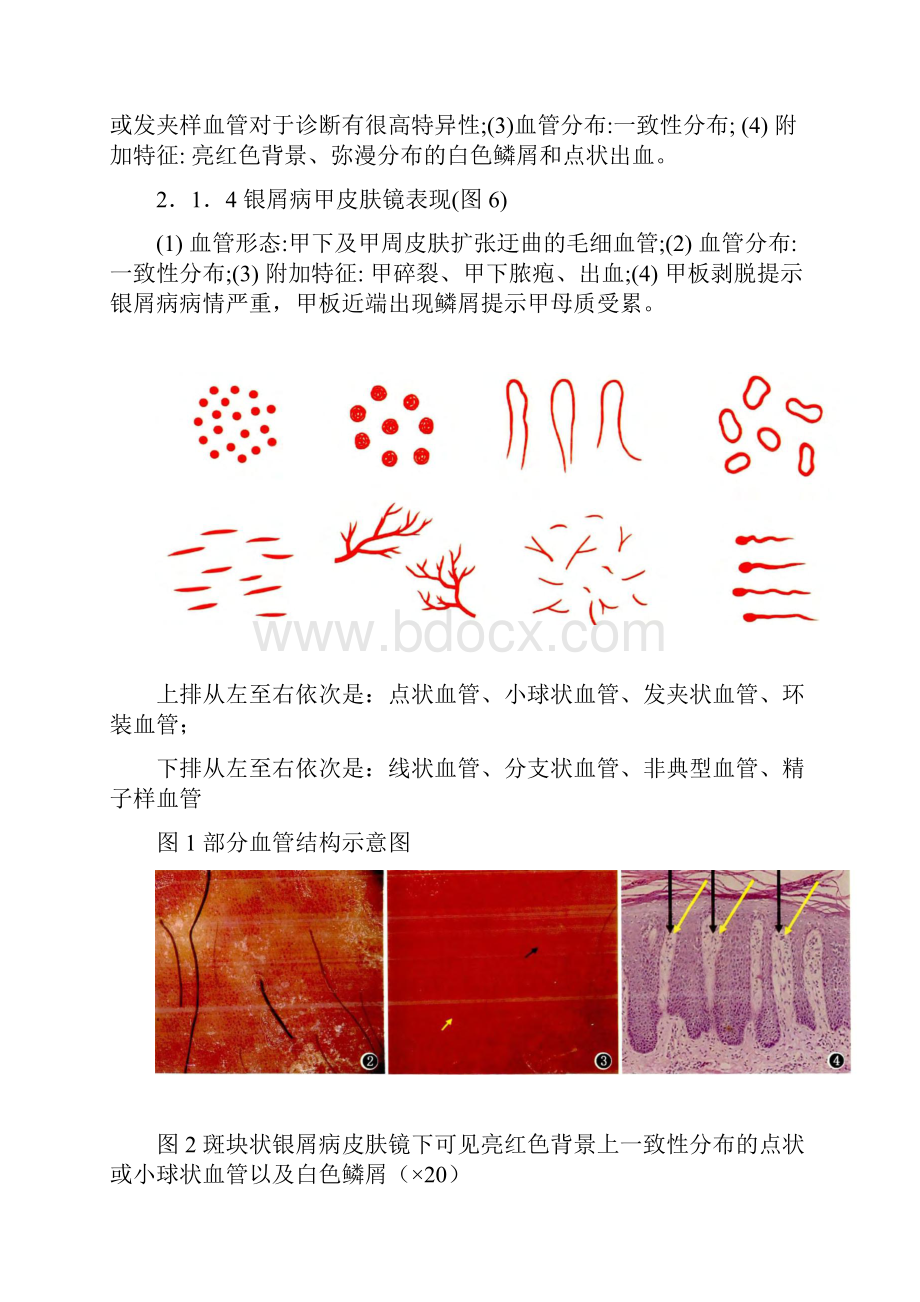 红斑鳞屑性皮肤病皮肤镜诊断专家共识版知识分享.docx_第3页