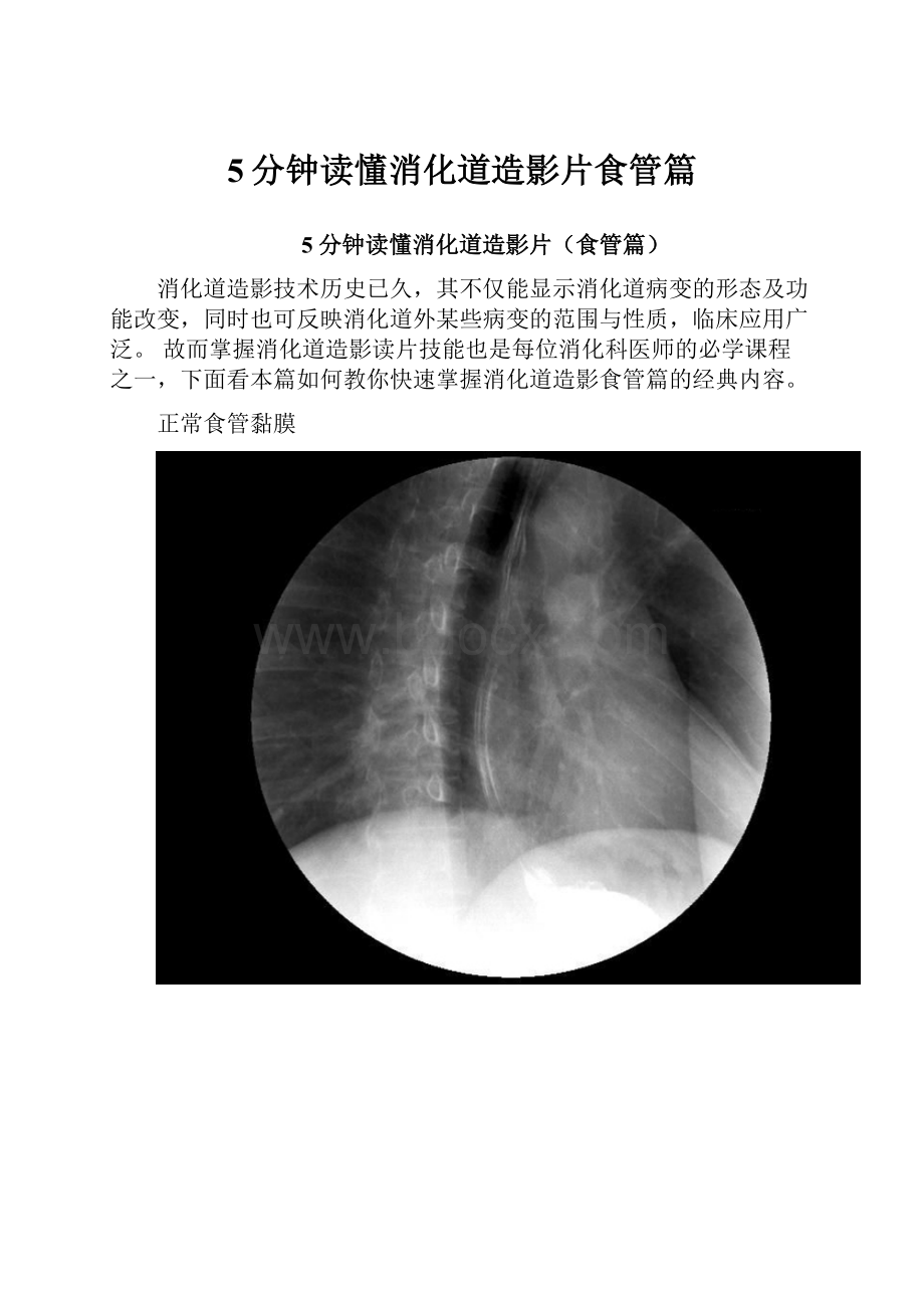 5分钟读懂消化道造影片食管篇.docx