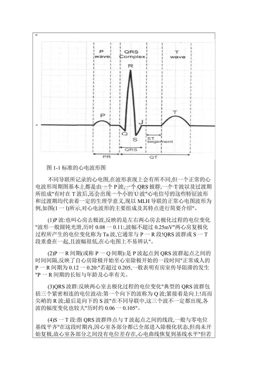 matlab心电信号R波检测.docx_第2页