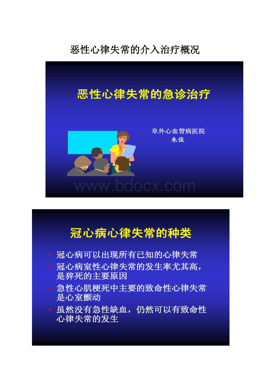 恶性心律失常的介入治疗概况.docx