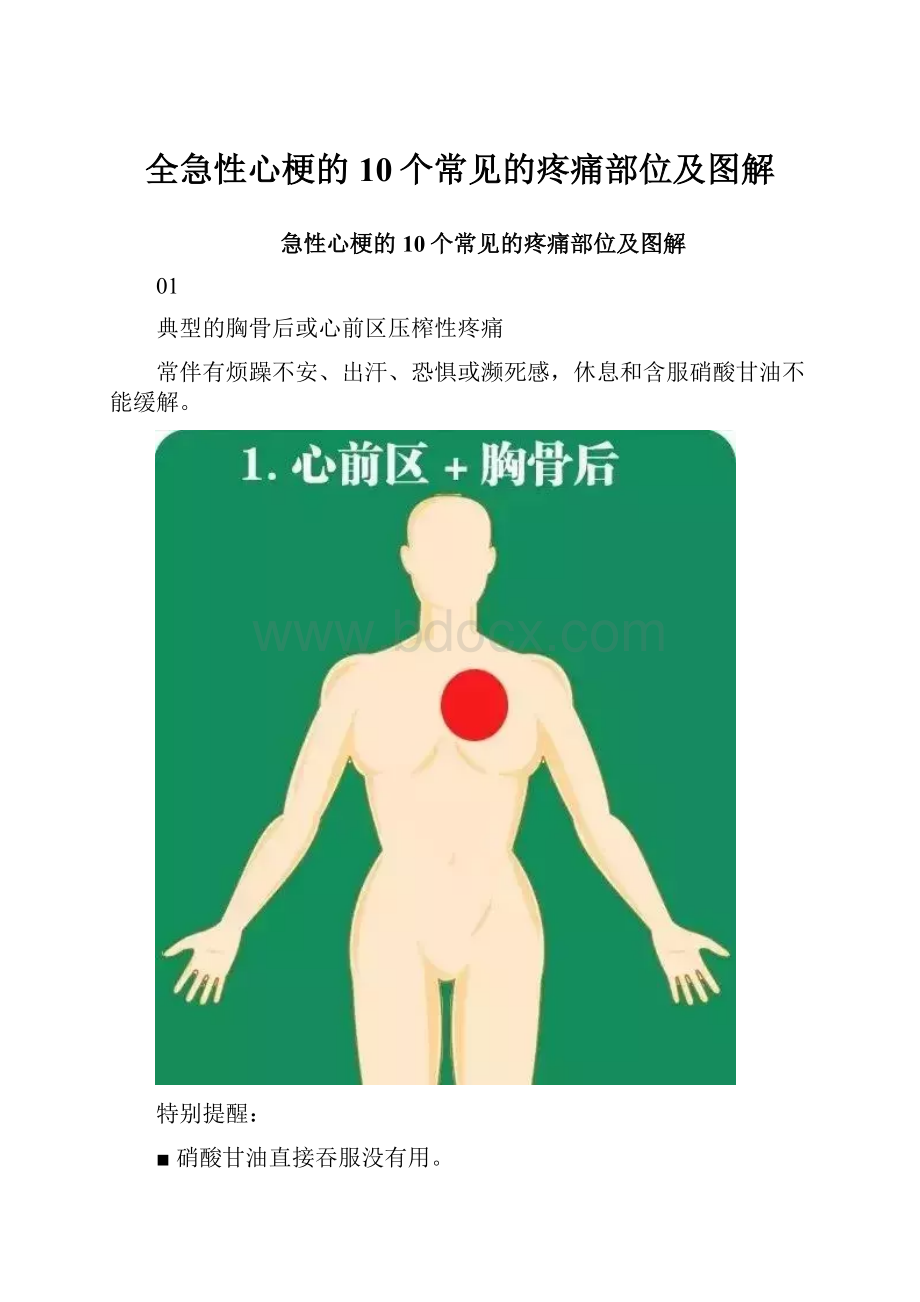 全急性心梗的10个常见的疼痛部位及图解.docx