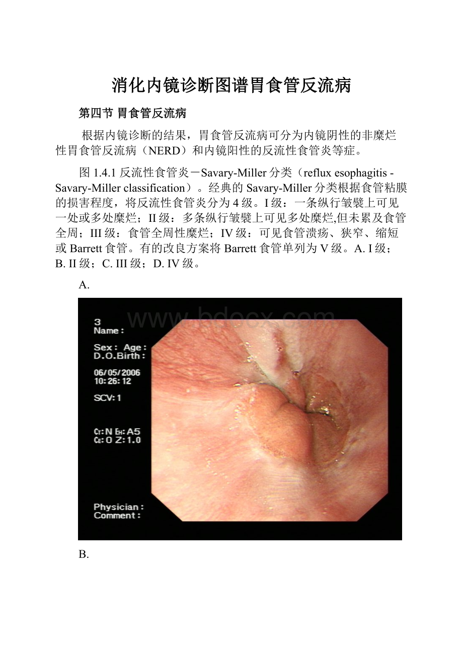 消化内镜诊断图谱胃食管反流病.docx