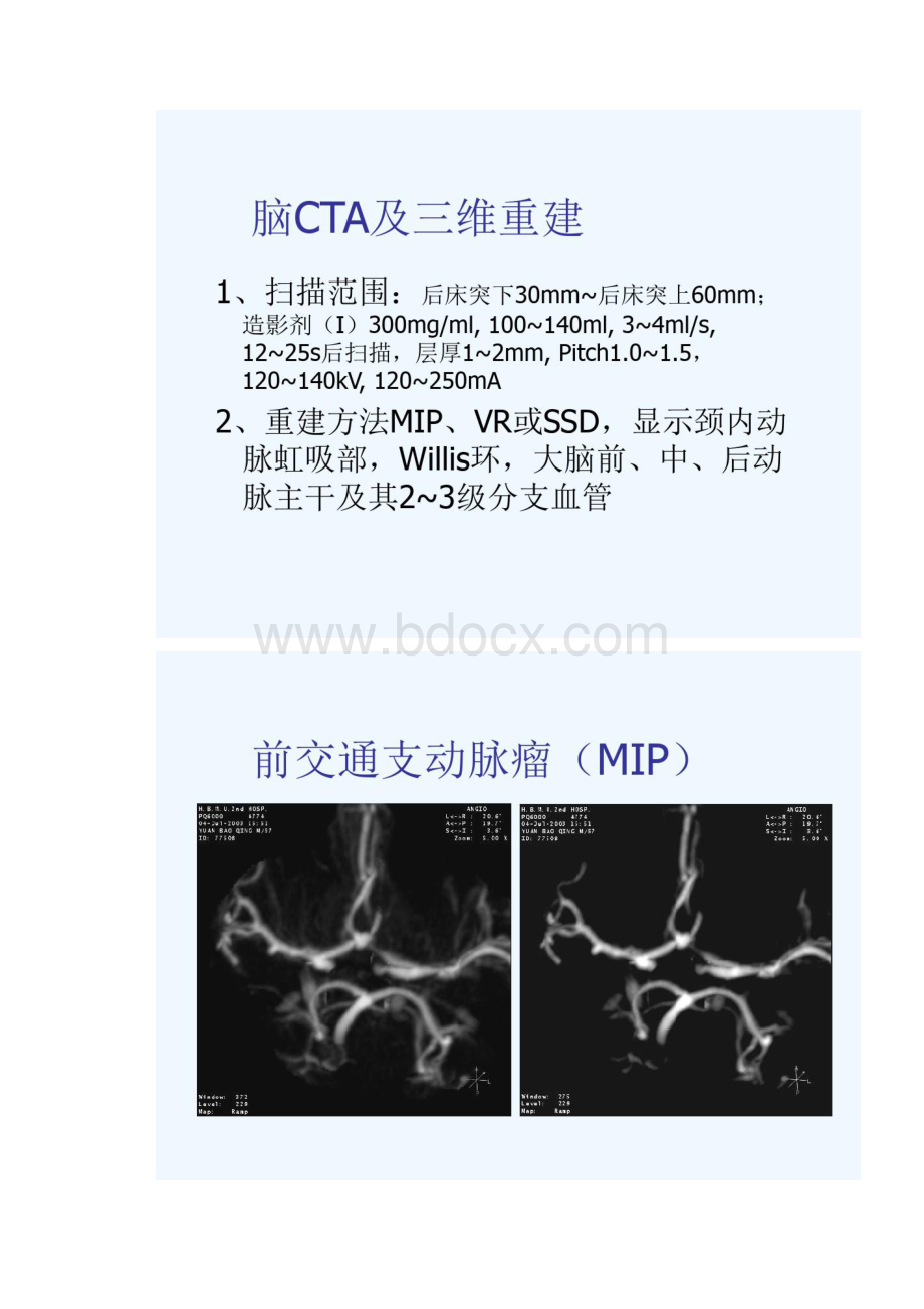 脑CTA后处理.docx_第3页