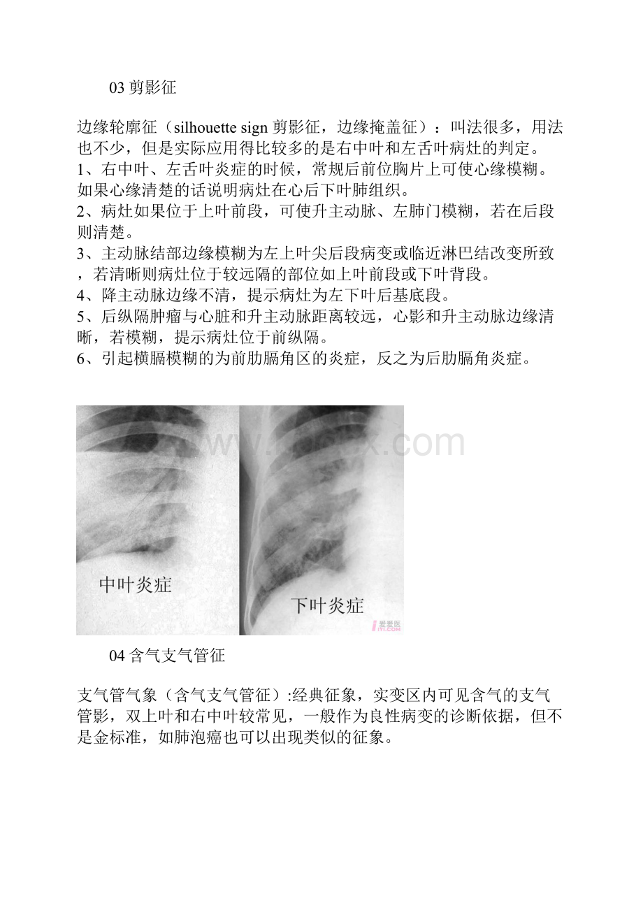 医学影像学各种征象综合.docx_第3页